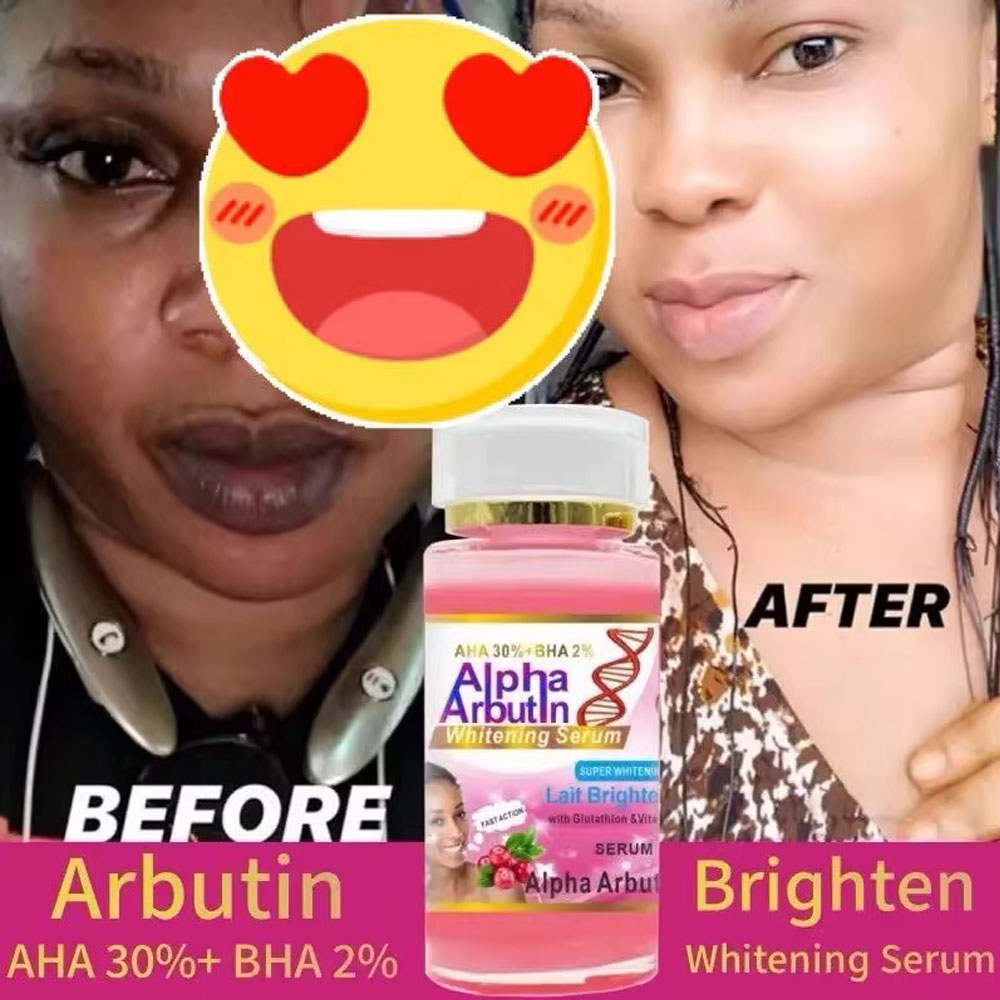 알파 알부틴 세럼 AHA 30%+ BHA 2% 얼굴을  - Alpha Arbutin Serum 리뷰 및 가격