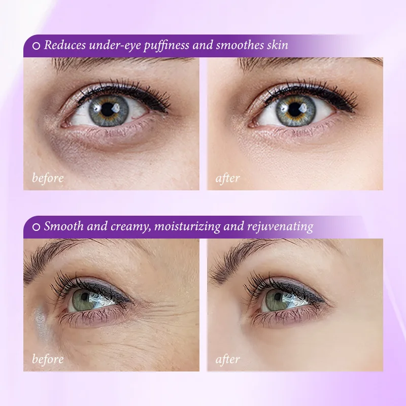 즉각적인 눈가 주름 제거 크림 레티놀 주름 개선 탄력  - Skincare D'Alba 리뷰 및 가격